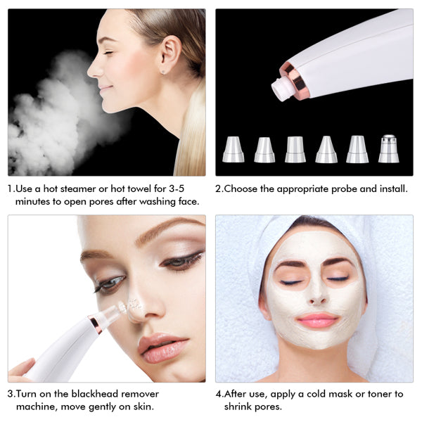 Blackhead Vacuum Pore Cleanser | 5-Head Microdermabrasion Device